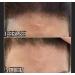 Pirene Organic Face Serum - Redness Relief Moisturizer for Dry Sensitive Skin Rosacea Eczema & Dermatitis | 1.0 fl oz Exfoliating Lotion - International Shipping Available - Buy Online on GoSupps.com