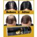 Hair Building Fibers + Hair Growth Oil with 5% Minoxidil Biotin Collagen - Thinning & Hair Loss Treatment - Medium Brown - Buy Online on GoSupps.com