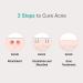 Patch Pro Micro Needle Patch: 9 Micro Needle Pimple Patches for Breakouts & Impurities - Invisible Spot Stickers for All Skin Types - 9 Count - Buy Online on GoSupps.com