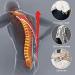 Kyphosis Corrector Brace Adjustable Back Posture Corrector Upper Back Support For Men Women For Kyphosis Hunch Relief And Hunchback Or Lordosis Spine Treatment XL Code Uptodate33 - Buy Online on GoSupps.com