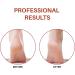 Large Foot Rasp: Callus Remover Tool for Wet and Dry Feet - Surgical Grade Stainless Steel - Buy Online on GoSupps.com