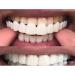 Dental Panel for Perfect Smile | Upper & Lower Tooth Solutions | Comfortable Fit Flexible Braces - Buy Online on GoSupps.com