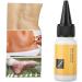 Scar Removal Cream - Acne Treatment, Repair Serum & Skin Regeneration - 20ml Scar Healing Oil - Buy Online on GoSupps.com