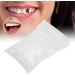 Dental Tooth Repair Beads - Temporary Filling Material - Thermal Adhesive - Degradable - 100g (Pack of 1) - Buy Online on GoSupps.com