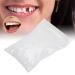Dental Filling Heat Beads 20g - Temporary Thermal Material for Missing or Broken Teeth - Buy Online on GoSupps.com