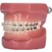 Dytah 1:1 Orthodontic Treatment Teeth Model - Patient Communication & Teaching Tool with Metal & Ceramic Brackets for Adults - Buy Online on GoSupps.com