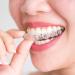 AMZLORD 4x Silicone Bite Track - Teeth Grinding Protection Splint for Snoring & Bruxism Relief - Buy Online on GoSupps.com