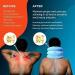 NeckFix Cervical Neck Traction Device for Instant Pain Relief - Pinched Nerve Stretcher + Bonus | 12-17 inch - Buy Online on GoSupps.com