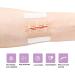 Emergency Wound Closure Strips - Butterfly Bandages for First Aid | Adhesive Sutures for Zipper Laceration Repair (S) - 1 Piece 2.76x1.97 - Buy Online on GoSupps.com
