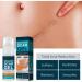 Kelo-cote Scar Gel 15g-2 Pack | Advanced Formula for Surgical, Stretch Marks, C-section, Cosmetic Surgery, Burn & Children's Scars | Softens, Flattens, Eliminates Redness - Buy Online on GoSupps.com