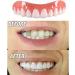 Upgrade Your Smile with Instant Cosmetic Snap-On Perfect Smile Teeth Whitening Denture Paste Brace - Buy Now! - Buy Online on GoSupps.com