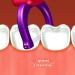 TEEsmile Evolutionary Clean Dental Flossers Kit - 200 Count Refill Pack - Buy Online on GoSupps.com
