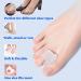 Gel Toe Separators 8 Pack - Toe Corrector & Spacer for Bunions, Hammer Toes, Overlapping Toes - Hallux Valgus Relief - Clear - Buy Online on GoSupps.com