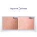 Even Skin Complexion Facial Cream - Calming Softening & Moisturizing 30g | International Shipping - Buy Online on GoSupps.com