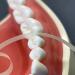 Ultra-Fine Lsojfe Tooth Sandpaper & Dental Polishing Strips - 20 m Interdental Grinding Tool 4mm Width - Buy Online on GoSupps.com