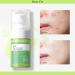 Salicylic Acid Solution Salicylic Acid 2% Solution Gentle Exfoliating Serum for Smoother & Clearer Skin Daily Use Facial Serum (20 mL) - Buy Online on GoSupps.com