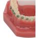Orthodontic Bracket Model - Dental Resin Model & Portable Metal Wire for Student Learning - Buy Online on GoSupps.com