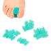 16 Pack Silicone Toe Separator for Bunion Correction - Soft, Flexible, and Skin-Friendly Foot Care Tool - Buy Online on GoSupps.com