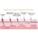 Derma Roller- 540 Needles Derma for Face and Skin Care 0.5mm - Buy Online on GoSupps.com