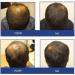 FOLIGAIN Shampoing ANTI CHUTE DE CHEVEUX et CALVITIE pour Homme | Contient 2% TRIOXIDIL | Soin cheveux fins et fragiles - Renforce et Densifie les cheveux | Stimule la REPOUSSE rapide - Sans sulfate - Buy Online on GoSupps.com
