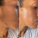 Hollywood Browzer Post Dermaplaning Perfection Oil - 24K Gold Facial Elixir - Face Serum 15ml - Buy Online on GoSupps.com