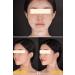 BNY Miracle Facial Peel 1.76 fl oz Mat Na Peel Da Sinh Hoc - Buy Online on GoSupps.com