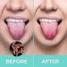Premium Steel Tongue Cleaner Toothbrush - High Hygiene Tongue Scraping Kit for Fresh Breath - Buy Online on GoSupps.com