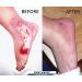 BerbereX Antimicrobial Wound Cleanser 4oz - First Aid Antiseptic Spray for Cuts, Scrapes, Burns, Wounds & Piercings - Buy Online on GoSupps.com