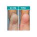 Premium Keratin Socks for Callus Softening, Moisturizing Foot Treatment - 12 Sock Pairs - Buy Online on GoSupps.com