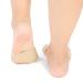 Silicone Toe Splint and Bunion Relief Kit for Hallux Valgus Correction and Foot Pain Relief - Buy Online on GoSupps.com