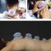 Cupping Glass Silicone Therapy Set - 5pcs Anti-Aging & Anti-Cellulite Massage Cups for Face & Body | International Shipping Available - Buy Online on GoSupps.com