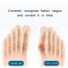 KTROK Bunion Splint Corrector - Adjustable Toe Separator for Pain Relief and Hallux Valgus Correction - Soft Padding for Comfort - Non-Surgical Transverse Arch Support - Buy Online on GoSupps.com