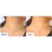 WHITESILK Retinaldehyde (0.1%) + Bakuchiol (1%) + Adenosine (7500ppm) INSTANT Wrinkle Smoothing & Line Filler SUPER Cream (30ml/1oz) K-Beauty  - Buy Online on GoSupps.com