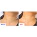 K-Beauty Retinaldehyde Night Repair Cream 1000ppm - Anti-Wrinkle Liposome Formula (1oz/30ml) - Shop Internationally - Buy Online on GoSupps.com