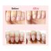 Miracle Cuticle Remover Oil Pusher - Nail and Toe Care Cleaner - Buy Online on GoSupps.com