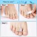 Carolhome 5 Pack Toe Wraps Splints - Toe Protectors & Correctors for Crooked and Overlapping Toes - Toe Spacer Bunion Corrector - Men and Women - Buy Online on GoSupps.com