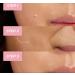 Vitality Precision Skin Acne Spot Patch - 36 Invisible Patches for Targeted Treatment - International Shipping Available - Buy Online on GoSupps.com