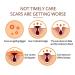 Buy 1PC Crocodile Repair Serum - Anti Scar Oil with Herbal Extract for Youthful Skin | 15ml - International Shipping - Buy Online on GoSupps.com