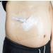 Shower Shield 8 x 8 PICC Line Cover Moisture Barrier Wound Dressing -One Week Supply (7 Pack)