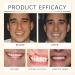 Ensemble de proth ses dentaires de qualit sup rieure Dents d'aspect naturel confortable pour un usage quotidien ensemble de proth ses compl tes personnalis es avanc es imperm ables et l g res 2 - Buy Online on GoSupps.com