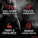 Insane Labz Psychotic High Stimulant Pre Workout Powder - Gummy Candy 35 Servings - Buy Online on GoSupps.com