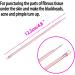 4PCS/SET Blackhead Removal Tool Pimple Cleansing Tool Kit Stainless Steel Acne Pimple Extractor Acne Remover Tool With Box(Rose Gold) pimple extractor - Buy Online on GoSupps.com