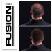 HAIR FUSION Dark Brown: 100% Real Human Hair Fibers for Baldness & Thinning - Root Touch Up, Volumizer - Unisex (1.05 oz) - Buy Online on GoSupps.com