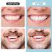 Natural Shade Tooth Repair Kit for Missing or Broken Teeth - 6PCS (D-1) Yellow - Buy Online on GoSupps.com