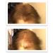 Caboki All-Natural Hair Building Fiber | Hair Loss Concealer for Bald Spots and Thinning Hair (Medium Brown) - 40-Day Supply - Buy Online on GoSupps.com