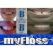 Orthodontic Gap Teeth Bands 3/16 - Heavy & Floss | 100-Pack - Buy Online on GoSupps.com