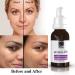 ican London Retinol 0.5% Serum Reducing Wrinkles Lines & Ageing on Face Under Eyes 30ml - Buy Online on GoSupps.com