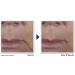 RoC - Multi Correxion Anti-Sagging Firm + Lift Face Cream - Prevent Facial Sagging & Enhance Contour Firmness - Hyaluronic Acid Bugrane & Shea Butter - Anti-Aging - Cosmetic Lifting Effect - 50 ml - Buy Online on GoSupps.com