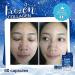 Gluta Frozen Collagen 2 In 1 Whitening Capsules - Nourishes Skin, Reduces Freckles, Dark Spots & Acne, Promotes Healthy Hair & Nails - 60 Capsules - Buy Online on GoSupps.com