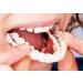 Flipped warmth veneers teeth at the top and bottom artificial teeth teeth for plug in braces lightening dentures false teeth temporary bleaching repair kit 2 pair